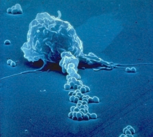 pseudopode